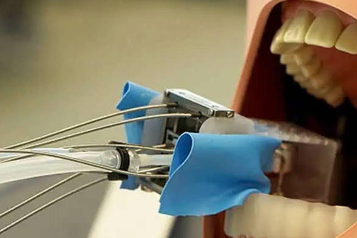 Horror: Deze tandartsrobot wordt aan je tand vastgezet voor het boren